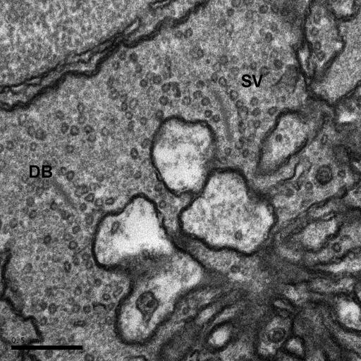  NCBI Organism:Danio rerio; Cell Types:Outer plexiform layer of retina Cell Components:synapse, Ribbon synapse, presynaptic active zone membrane; Biological process:synapse organization, synaptic transmission;