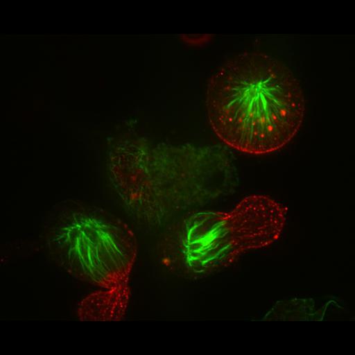  NCBI Organism:Homo sapiens; Cell Types:epithelial cell Cell Components:microtubule, chromosome passenger complex; Biological process:cytokinesis