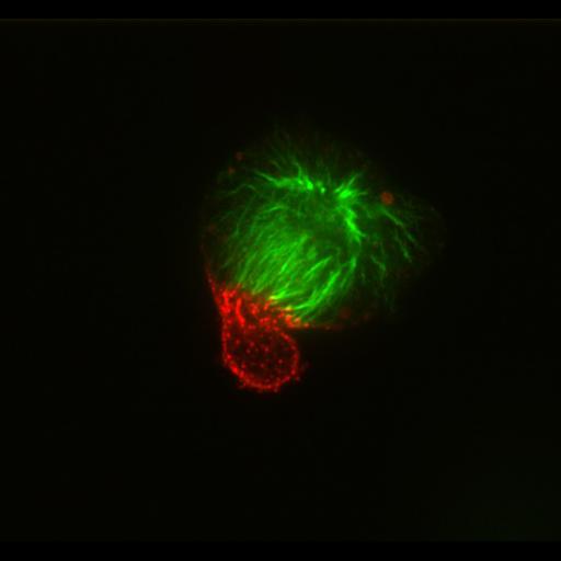  NCBI Organism:Homo sapiens; Cell Types:epithelial cell Cell Components:microtubule, chromosome passenger complex; Biological process:cytokinesis