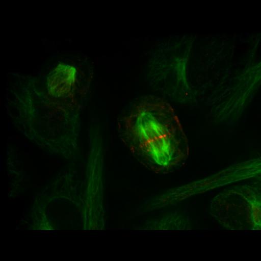  NCBI Organism:Homo sapiens; Cell Types:epithelial cell Cell Components:microtubule Biological process:microtubule-based movement