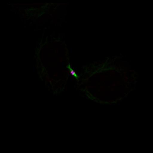  NCBI Organism:Homo sapiens; Cell Types:epithelial cell Cell Components:microtubule, kinesin complex, midbody; Biological process:cytokinesis