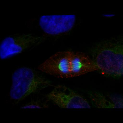  NCBI Organism:Homo sapiens; Cell Types:epithelial cell Cell Components:microtubule, nucleus; Biological process:cytokinesis