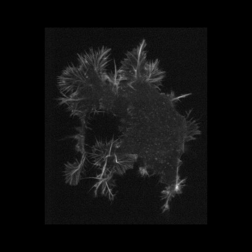  NCBI Organism:mouse/rat NG108-15; Cell Components:growth cone Biological process:axon guidance