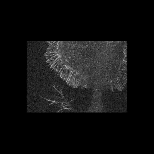  NCBI Organism:mouse/rat NG108-15; Cell Components:growth cone Biological process:axon guidance