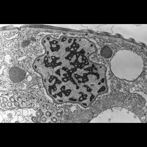  NCBI Organism:Opercularia [NCBITaxon:168247], , ; Cell Types:cell by organism, eukaryotic cell, , ; Cell Components:integral to contractile vacuolar membrane, smooth endoplasmic reticulum, , micronucleus; Biological process:water transport, , micronucleus organization;