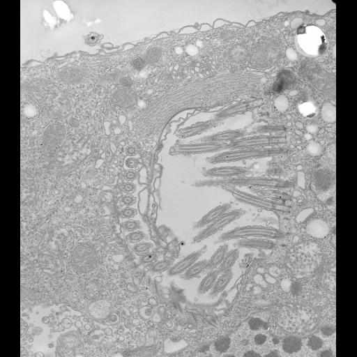  NCBI Organism:Halteria grandinella; Cell Types:cell by organism, eukaryotic cell, , ; Cell Components:oral apparatus, cytoskeleton, ciliary rootlet; Biological process:cytoskeleton organization, response to food;