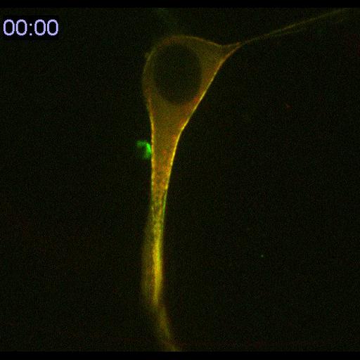  NCBI Organism:Mus musculus; Cell Types:blood vessel endothelial cell, primary cell line cell; Cell Components:myosin II complex Biological process:cell division, actomyosin contractile ring contraction;