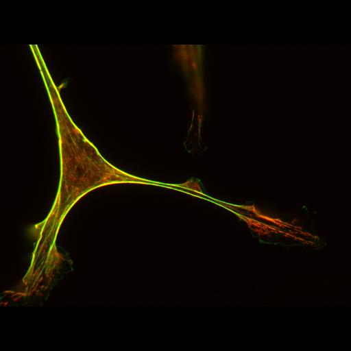  NCBI Organism:Mus musculus; Cell Types:blood vessel endothelial cell, primary cell line cell; Cell Components:actin cytoskeleton, myosin complex; Biological process:actomyosin structure organization