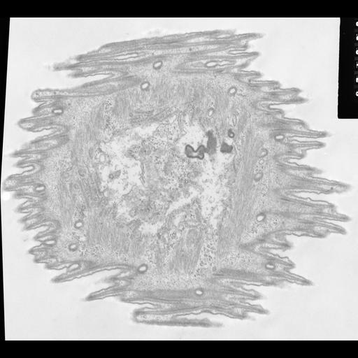  NCBI Organism:Opercularia [NCBITaxon:168247], , ; Cell Types:cell by organism, eukaryotic cell, , ; Cell Components:, smooth endoplasmic reticulum, clathrin coat of coated pit; Biological process:, ;