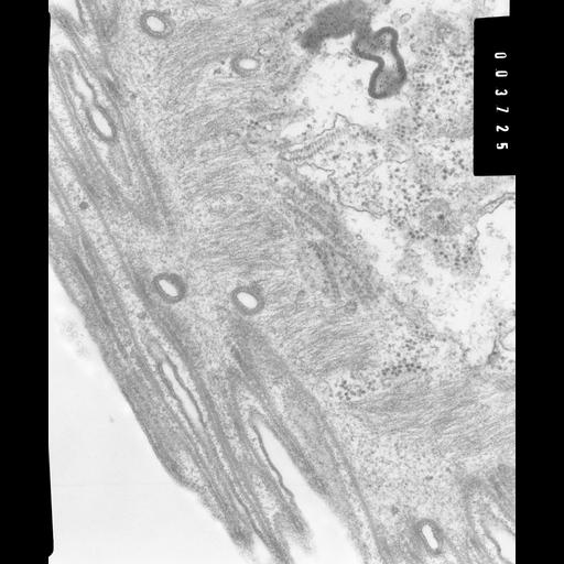  NCBI Organism:Opercularia [NCBITaxon:168247], , ; Cell Types:cell by organism, eukaryotic cell, , ; Cell Components:, ; Biological process:cytoskeleton organization, ;