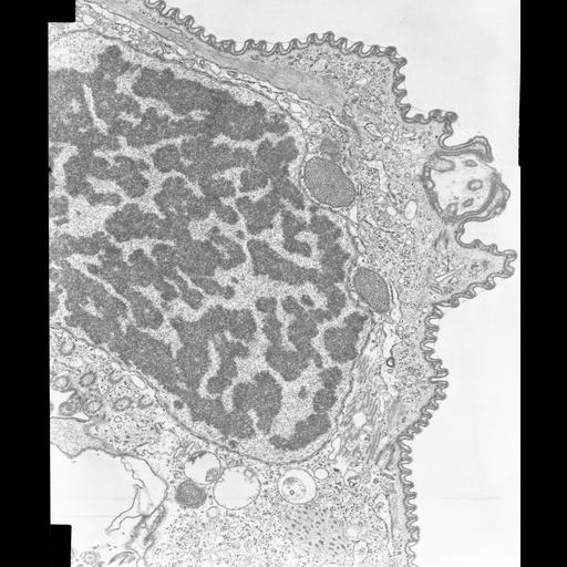  NCBI Organism:Opercularia [NCBITaxon:168247], , ; Cell Types:cell by organism, eukaryotic cell, , ; Cell Components:macronucleus, extracellular region, extracellular space, microtubule basal body; Biological process:cell adhesion, heterochromatin organization, chromosome organization;