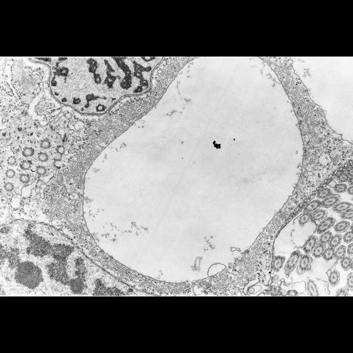  NCBI Organism:Opercularia [NCBITaxon:168247], , ; Cell Types:cell by organism, eukaryotic cell, , ; Cell Components:contractile vacuole, macronucleus, micronucleus, microtubule basal body; Biological process:, micronucleus organization;