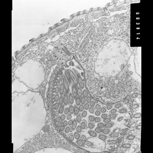  NCBI Organism:Opercularia [NCBITaxon:168247], , ; Cell Types:cell by organism, eukaryotic cell, , ; Cell Components:oral apparatus, contractile vacuole, microtubule basal body;