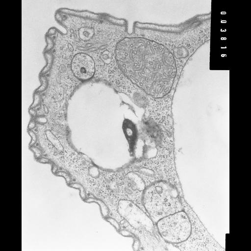  NCBI Organism:Opercularia [NCBITaxon:168247], , ; Cell Types:cell by organism, eukaryotic cell, , ; Cell Components:clathrin coat of coated pit, plasma membrane organization, , ; Biological process:plasma membrane to endosome transport, clathrin coat assembly, cytoskeletal anchoring at plasma membrane, , plasma membrane organization;