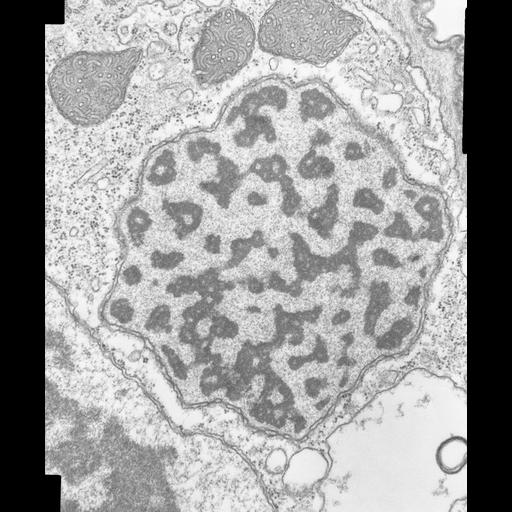  NCBI Organism:Opercularia [NCBITaxon:168247], , ; Cell Types:cell by organism, eukaryotic cell, , ; Cell Components:micronucleus, macronucleus, nuclear pore; Biological process:micronucleus organization, macronucleus organization, nucleocytoplasmic transport, ;