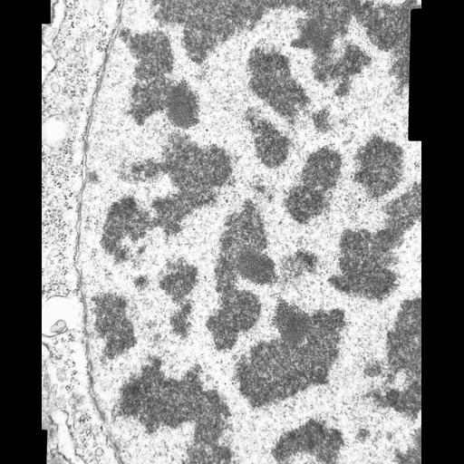  NCBI Organism:Opercularia [NCBITaxon:168247], , ; Cell Types:cell by organism, eukaryotic cell, , ; Cell Components:macronucleus, nuclear pore, nucleolus, heterochromatin, nuclear envelope; Biological process:nucleolus organization, nucleus organization, chromatin organization;