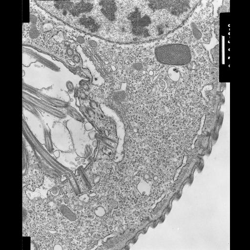  NCBI Organism:Opercularia [NCBITaxon:168247], , ; Cell Types:cell by organism, eukaryotic cell, , ; Cell Components:myofibril, macronucleus, Golgi stack; Biological process:cytoskeletal anchoring at plasma membrane, , Golgi organization, cytoplasm organization;