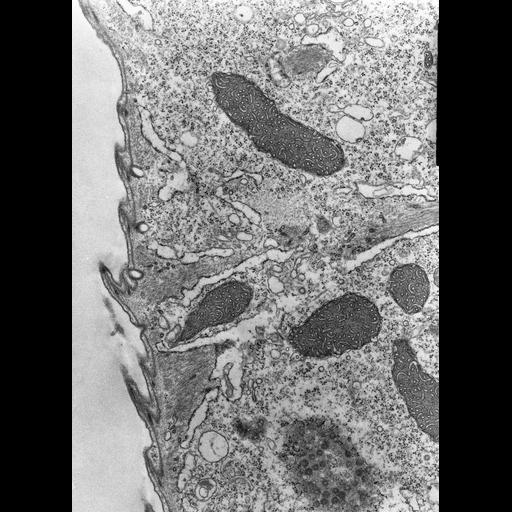  NCBI Organism:Opercularia [NCBITaxon:168247], , ; Cell Types:cell by organism, eukaryotic cell, , ; Cell Components:nuclear pore, , cytoplasm, clathrin coat, mitochondrion; Biological process:nucleocytoplasmic transport, cytoplasm organization, regulation of transmembrane transporter activity;