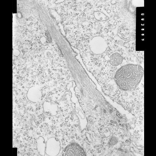  NCBI Organism:Opercularia [NCBITaxon:168247], , ; Cell Types:cell by organism, eukaryotic cell, , ; Cell Components:cortical actin cytoskeleton, , rough endoplasmic reticulum, peroxisomal membrane, peroxisomal matrix, mitochondrial inner membrane; Biological process:, ;