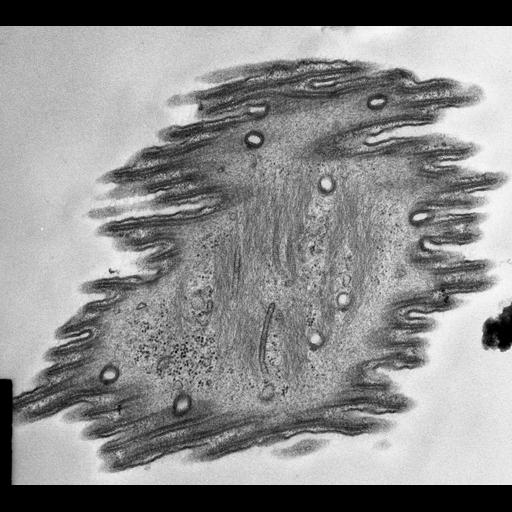  NCBI Organism:Opercularia [NCBITaxon:168247], , ; Cell Types:cell by organism, eukaryotic cell, , ; Cell Components:contractile fiber, rough endoplasmic reticulum, clathrin vesicle coat; Biological process:, ;