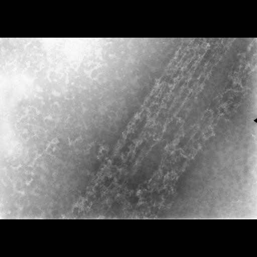  Cell Types:erythrocyte Cell Components:nuclear chromatin Biological process:DNA packaging