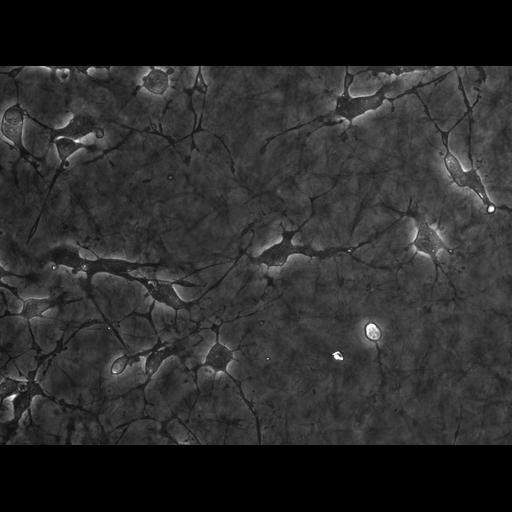  NCBI Organism:Mus musculus; Cell Types:blood vessel endothelial cell, primary cell line cell; Cell Components:cell, extracellular matrix; Biological process:cell migration