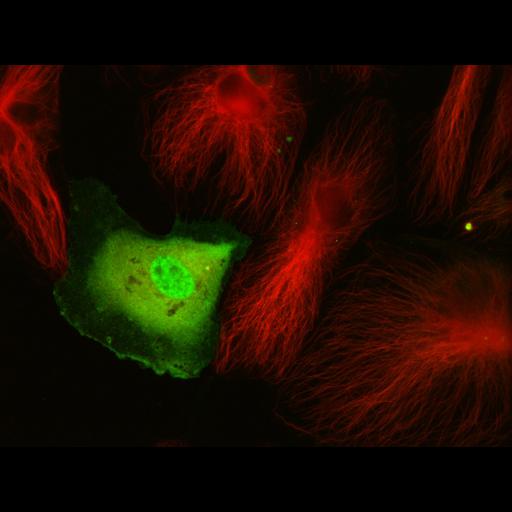  NCBI Organism:Homo sapiens; Cell Types:endothelial cell, primary cell line cell; Cell Components:kinesin complex, microtubule; Biological process:protein localization to chromosome, centromeric region