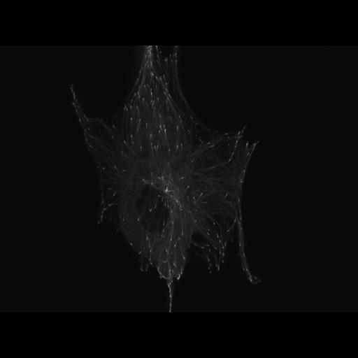  NCBI Organism:Homo sapiens; Cell Types:fibroblast, primary cell line cell; Cell Components:microtubule plus end Biological process:microtubule polymerization