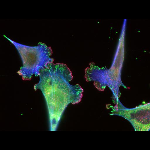  NCBI Organism:Mus musculus; Cell Types:fibroblast, primary cell line cell; Cell Components:focal adhesion, actin cytoskeleton; Biological process:cell adhesion, actin filament polymerization;