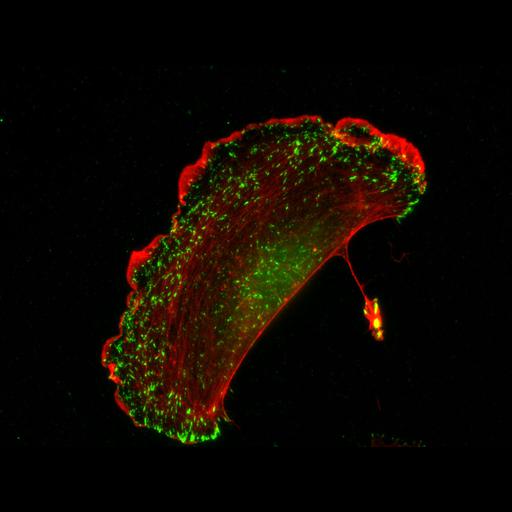  NCBI Organism:Homo sapiens; Cell Types:primary cell line cell, endothelial cell; Cell Components:focal adhesion, actin cytoskeleton; Biological process:regulation of focal adhesion assembly