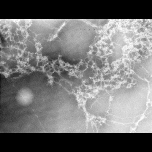  Cell Types:erythrocyte Cell Components:nuclear chromatin Biological process:DNA packaging