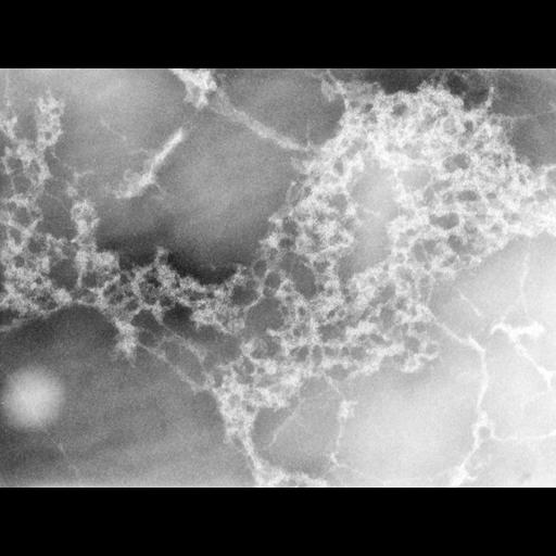  Cell Types:erythrocyte Cell Components:nuclear chromatin Biological process:DNA packaging