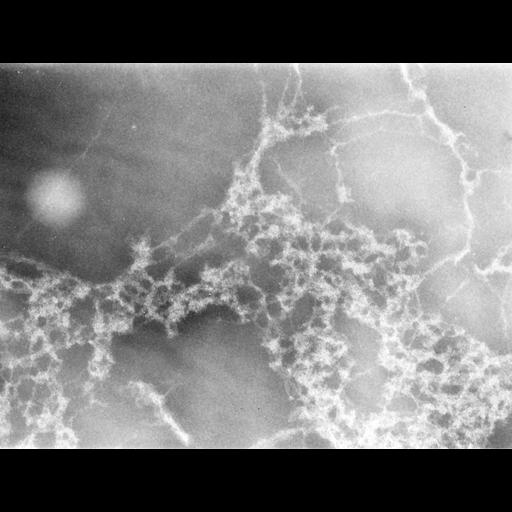  Cell Types:erythrocyte Cell Components:nuclear chromatin Biological process:DNA packaging