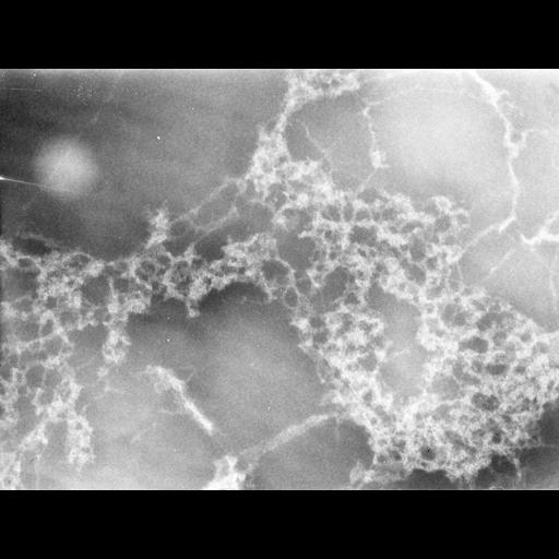  Cell Types:erythrocyte Cell Components:nuclear chromatin Biological process:DNA packaging