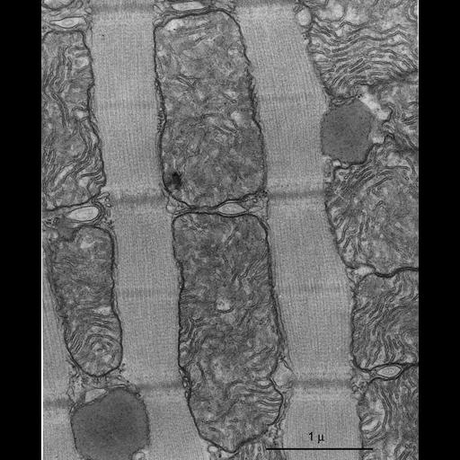  NCBI Organism:Myotis lucifugus; Cell Types:cardiac muscle cell Cell Components:mitochondrion Biological process:sarcomere organization