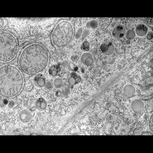  NCBI Organism:Rattus; Cell Types:hepatocyte Cell Components:lysosome Biological process:lipid digestion