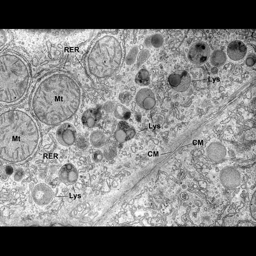  NCBI Organism:Rattus; Cell Types:hepatocyte Cell Components:lysosome Biological process:lipid digestion