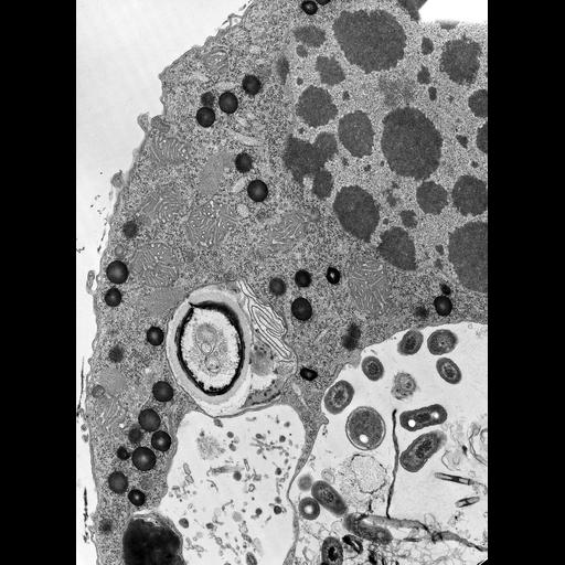  NCBI Organism:Halteria grandinella; Cell Types:cell by organism, eukaryotic cell, , ; Cell Components:macronucleus, pigment granule, food vacuole; Biological process:macronucleus organization, cellular pigmentation, digestion;