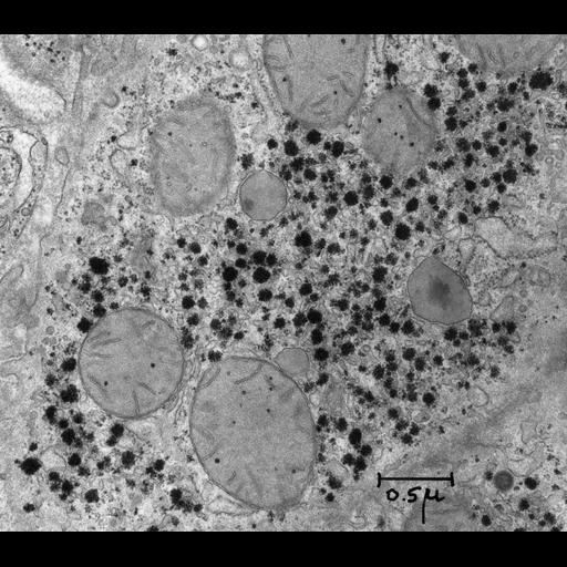  NCBI Organism:Rattus; Cell Types:hepatocyte Cell Components:glycogen granule Biological process:glycogen biosynthetic process