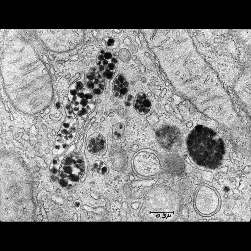  NCBI Organism:Rattus; Cell Types:hepatocyte Cell Components:Golgi apparatus, smooth endoplasmic reticulum, very-low-density lipoprotein particle; Biological process:lipoprotein biosynthetic process