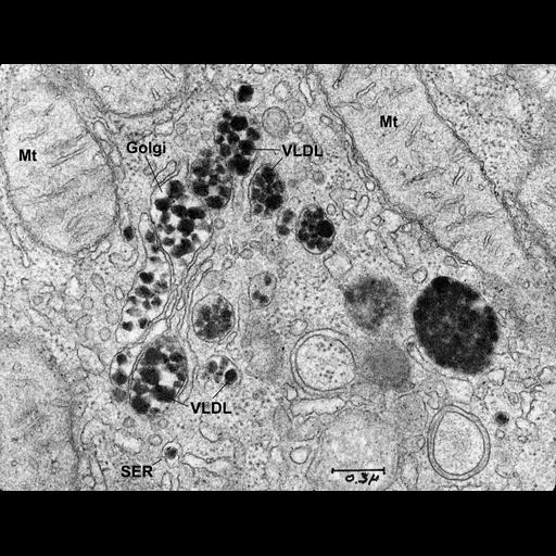  NCBI Organism:Rattus; Cell Types:hepatocyte Cell Components:Golgi apparatus, smooth endoplasmic reticulum, very-low-density lipoprotein particle; Biological process:lipoprotein biosynthetic process