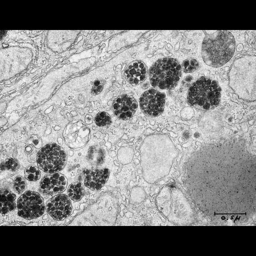  NCBI Organism:Rattus; Cell Types:hepatocyte Cell Components:secretory granule, very-low-density lipoprotein particle; Biological process:secretion