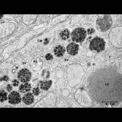  NCBI Organism:Rattus; Cell Types:hepatocyte Cell Components:secretory granule, very-low-density lipoprotein particle; Biological process:secretion