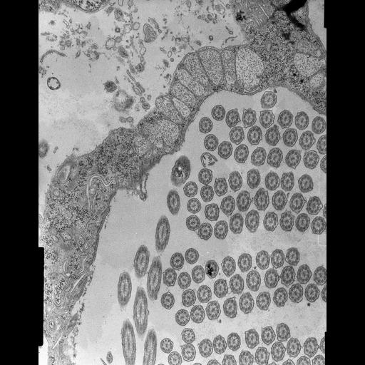  NCBI Organism:Halteria grandinella; Cell Types:cell by organism, eukaryotic cell, , ; Cell Components:cilium axoneme, , food vacuole; Biological process:ciliary or flagellar motility, digestion, ;