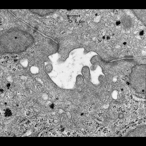  NCBI Organism:Cavia porcellus; Cell Types:hepatocyte Cell Components:tight junction, zonula adherens, desmosome; Biological process:canalicular bile acid transport