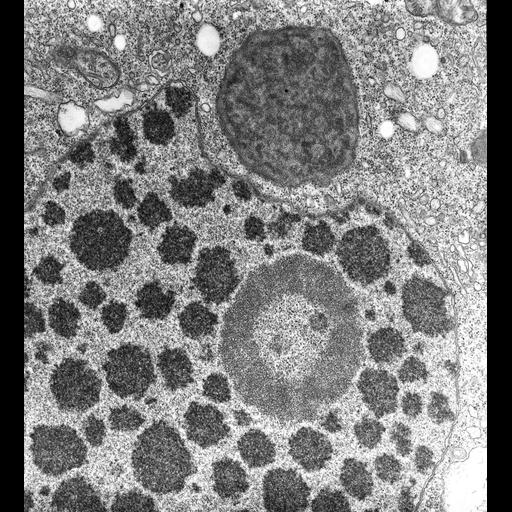  NCBI Organism:Halteria grandinella; Cell Types:cell by organism, eukaryotic cell, , ; Cell Components:macronucleus, , nucleolus, nuclear pore, nuclear chromatin; Biological process:, , , nuclear pore distribution, nucleus organization;