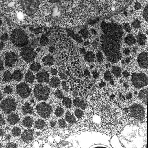  NCBI Organism:Halteria grandinella; Cell Types:cell by organism, eukaryotic cell, , ; Cell Components:macronucleus, nucleolus; Biological process:DNA replication checkpoint, nucleus organization;