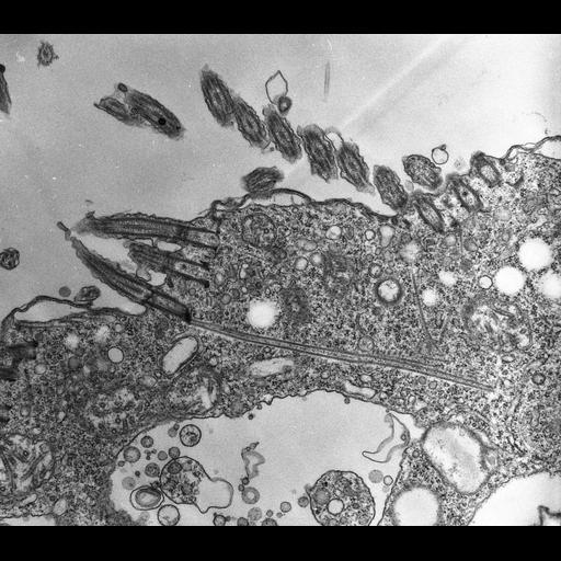  NCBI Organism:Halteria grandinella; Cell Types:cell by organism, eukaryotic cell, , ; Cell Components:microtubule basal body, microtubule cytoskeleton; Biological process:microtubule cytoskeleton organization, microtubule bundle formation, microtubule basal body organization;