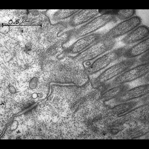  NCBI Organism:Rattus rattus; Cell Types:epithelial cell, ; Cell Components:zonula adherens, occluding junction, brush border membrane, microvillus, desmosome, actin filament, intermediate filament, plasma membrane;