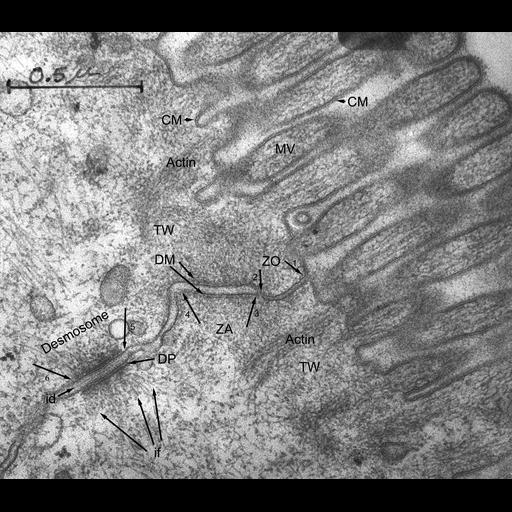  NCBI Organism:Rattus rattus; Cell Types:epithelial cell, ; Cell Components:zonula adherens, occluding junction, brush border membrane, microvillus, desmosome, actin filament, intermediate filament, plasma membrane;